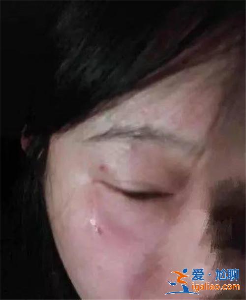 徐峥殴打女记者怎么回事 徐峥殴打女记者事件全程回顾