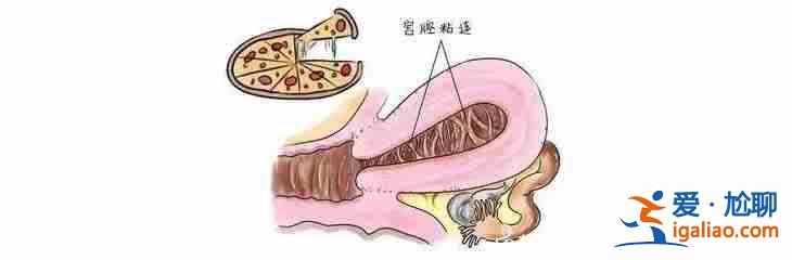 试管选性别包男孩费用？