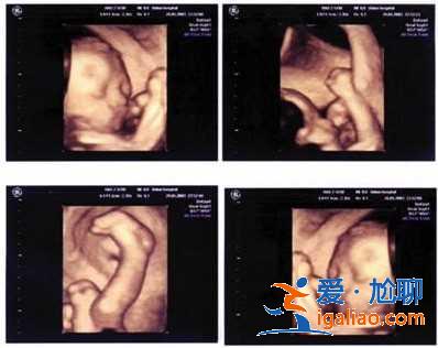 口碑好的助孕价格表？