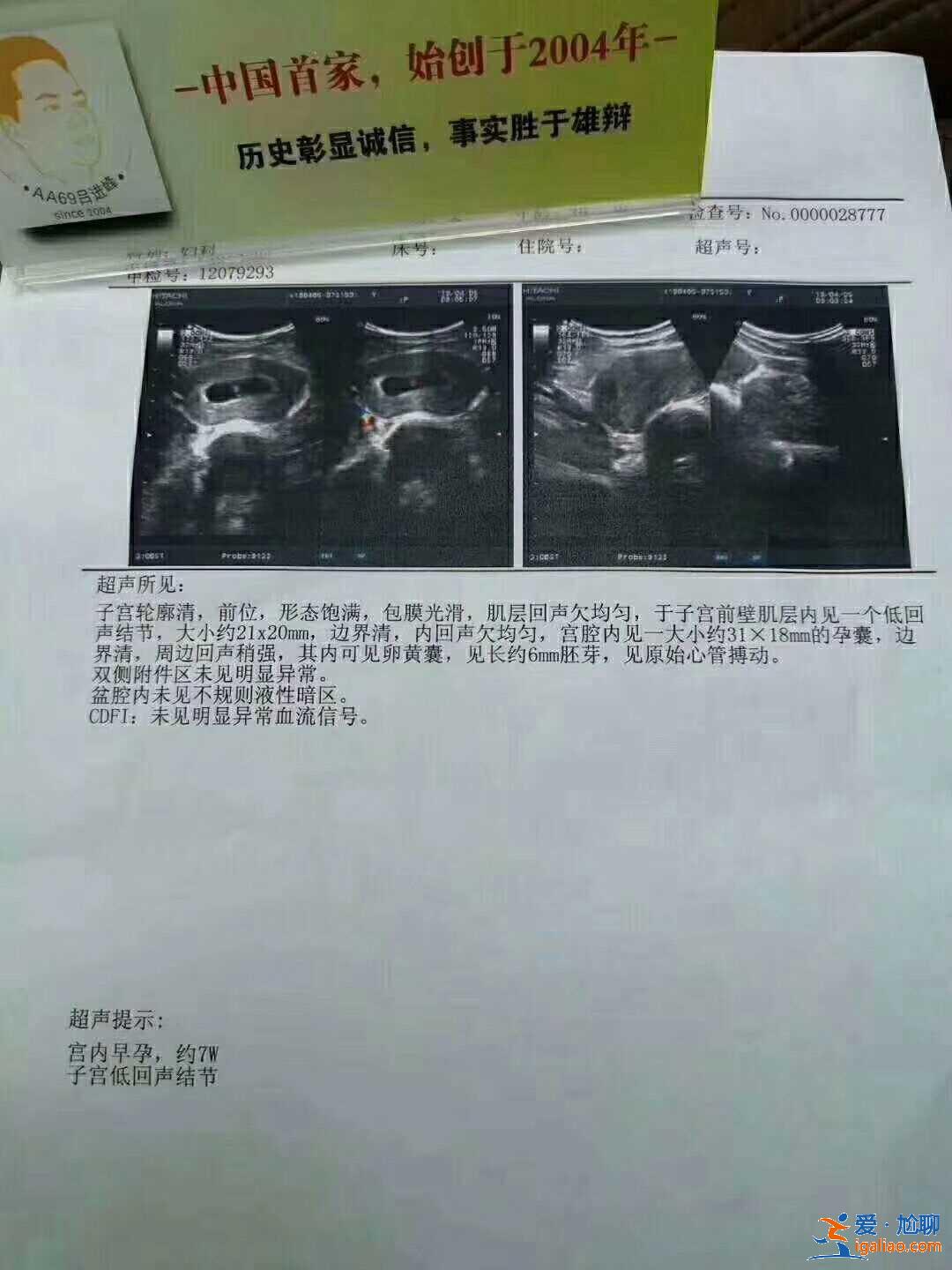 哈尔滨供卵助孕试管,怎样才能做好优生优育？