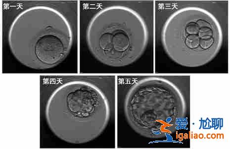 北京代生男孩费用-糜蛋白酶助孕生男生女预测表？