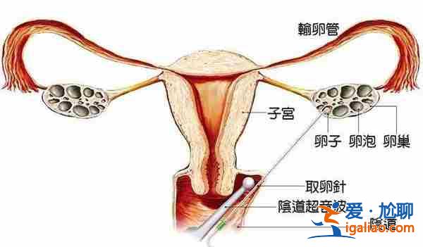 解说一下石家庄代生怀孕公司[ 1w多成功案例 ]？