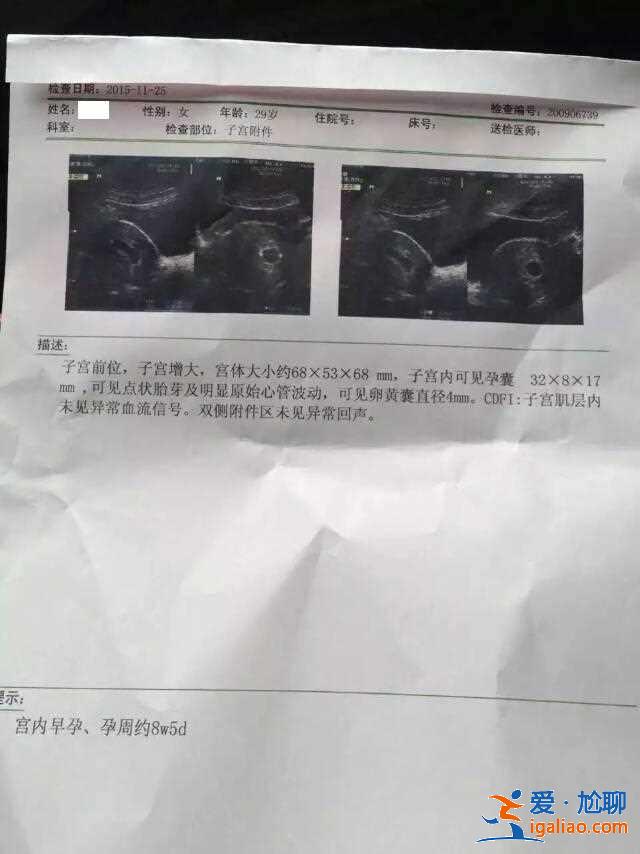 代怀小孩哪家优惠，备孕期间吃鹿胎膏有助孕效果吗？
