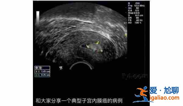 南宁代生孩子包成功_专业诚信？