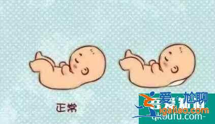 孕前nt检查有必要吗？？