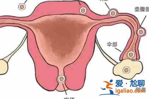 南通代生宝宝[ 技术介绍 ]？