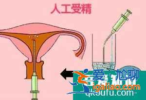 人工授精的过程是什么样的？？