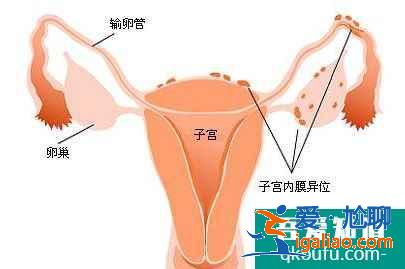 供卵试管婴儿：高龄生子做第三代成功率高吗？