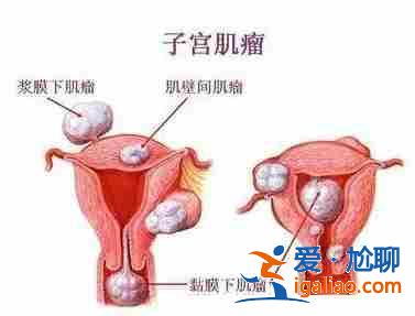 说一下北京代生怀孕公司【行业领跑】？