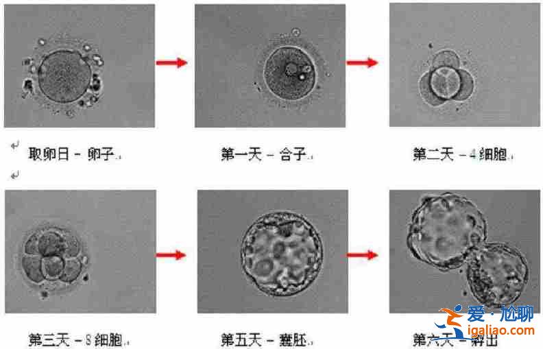 解说俄罗斯同性试管婴儿能做龙凤胎吗_成功率高？