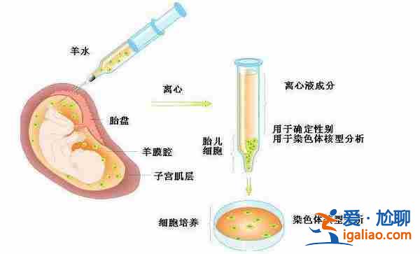 兰州代生孩子包成功？