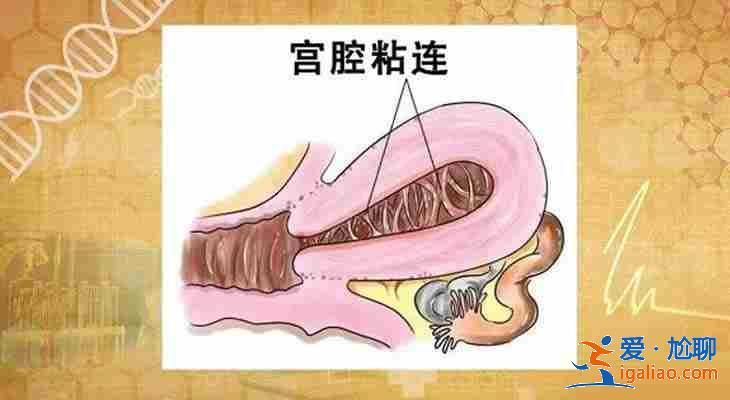 天津代生助孕[ 高端技术三甲助孕 ]？
