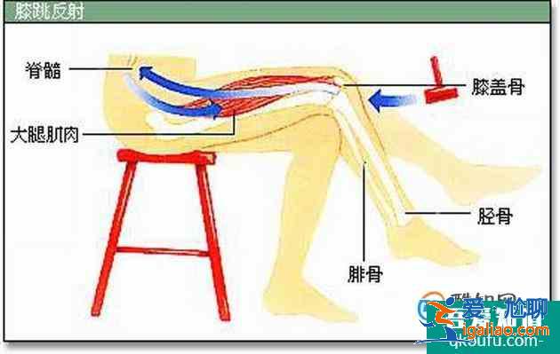 如何区分条件反射和无条件反射？？