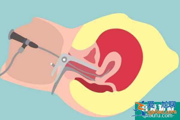 重度宫腔粘连，赴美做试管婴儿选用哪种方案？？
