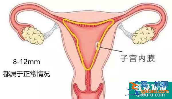 重度宫腔粘连，赴美做试管婴儿选用哪种方案？？