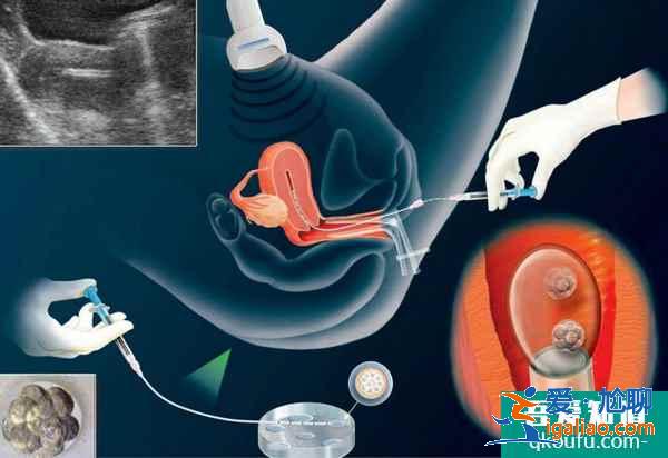 大龄女性去做试管婴儿，有哪些优势呢？？