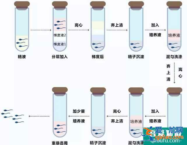 精液不液化赴美做试管婴儿，ICSI成功率有多高？？