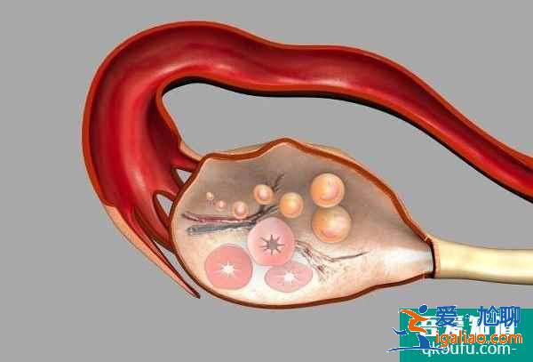 试管婴儿促排卵与乳腺癌之间到底有没有关系？？