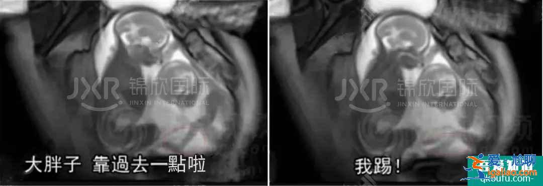 试管专家告诉你：如何怀双胞胎，你怀双胎的几率高吗？？