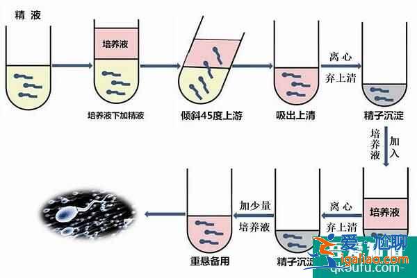 试管婴儿专家：赴美IVF前远离辐射、提高精卵质量？