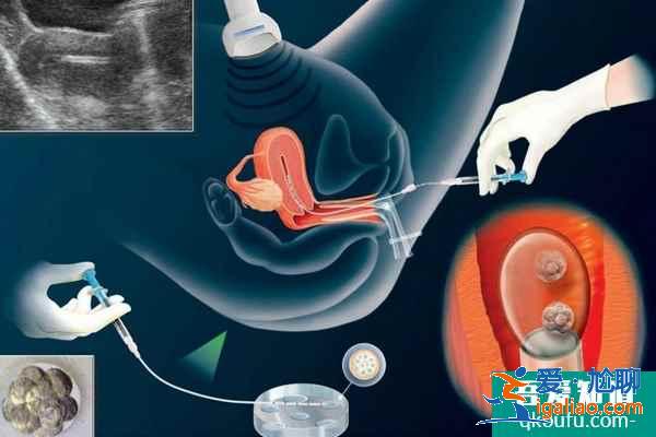 试管婴儿专家：从4个方面确保IVF的安全性？