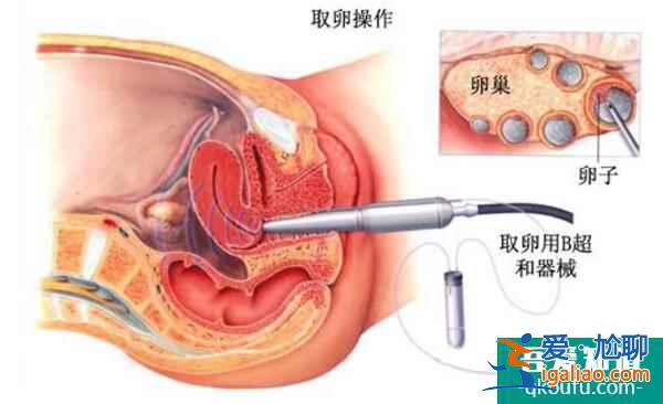 泰国试管婴儿周期安全性高，主要体现在以下三个方面？