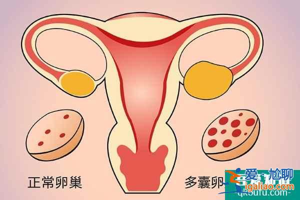 泰国试管婴儿专家：探究引起不孕症的原因与好孕方案？