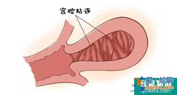 泰国试管婴儿专家：探究引起不孕症的原因与好孕方案？