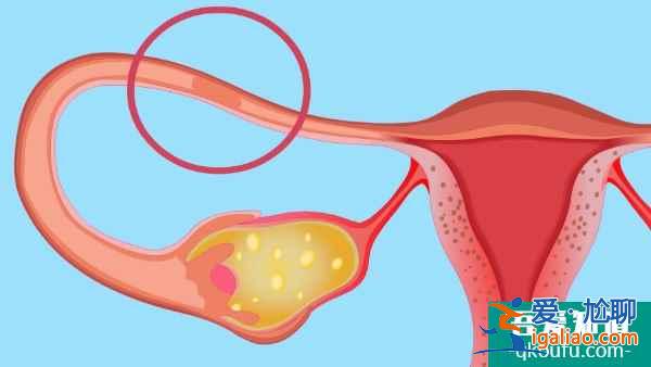 输卵管堵塞影响泰国试管婴儿成功吗？？
