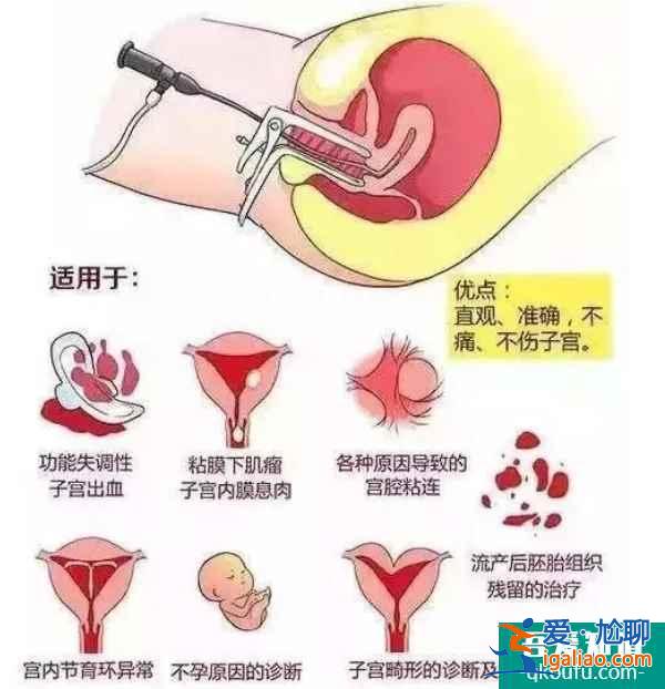解惑：赴美做试管婴儿还需要做宫腔镜检查吗？？