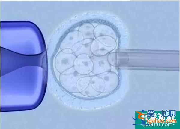 试管婴儿之“养囊”养出的好孕气，你知道吗？？