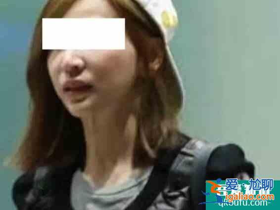 有些女明星为啥越做医美越衰老？