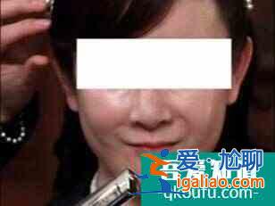 有些女明星为啥越做医美越衰老？