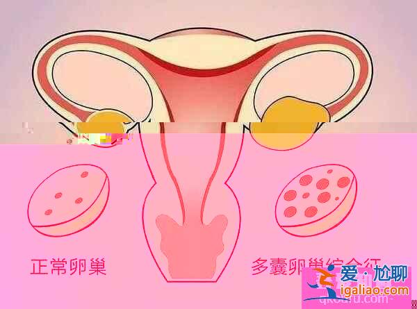 卵泡发育不良如何通过第三代试管婴儿助孕成功？