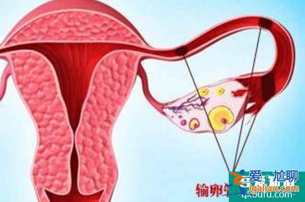 第三代试管婴儿助力摆脱生育困扰，圆幸福家庭？