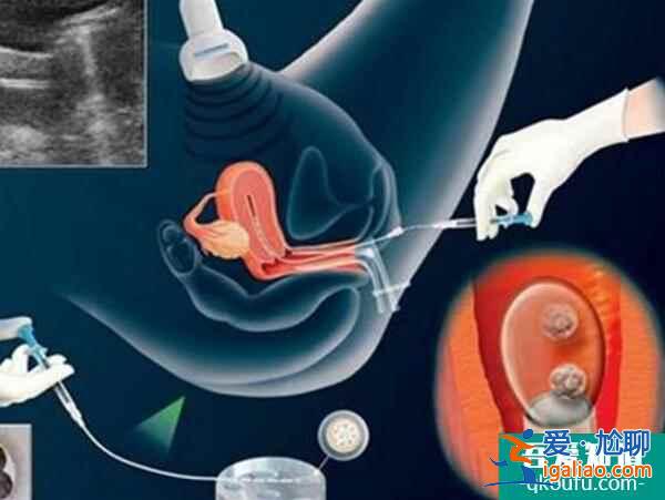 导致胎停的因素有哪些？试管婴儿可以预防吗？？