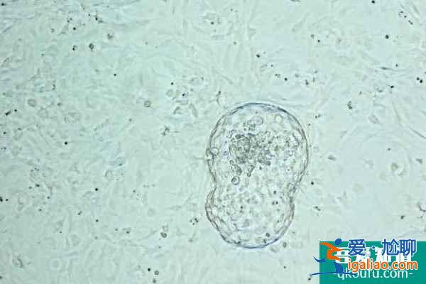 分析胚胎碎片率高的原因，试管婴儿如何规避？？
