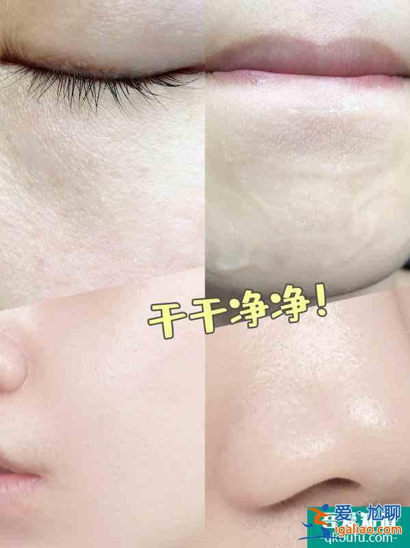 女明星的护肤方法解决了我的痘痘痘印问题！？