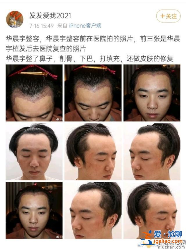 华晨宇22日晒纹身照  华晨宇整容照片曝光