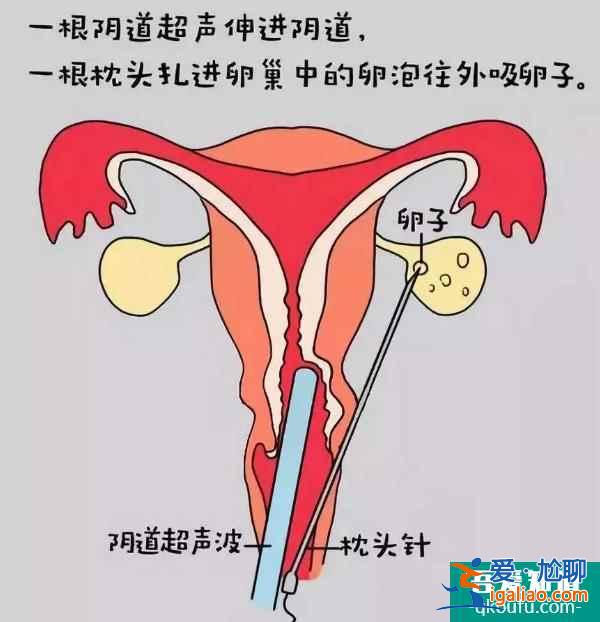 试管婴儿宝宝能自然分娩吗？诞生历程是怎样？？