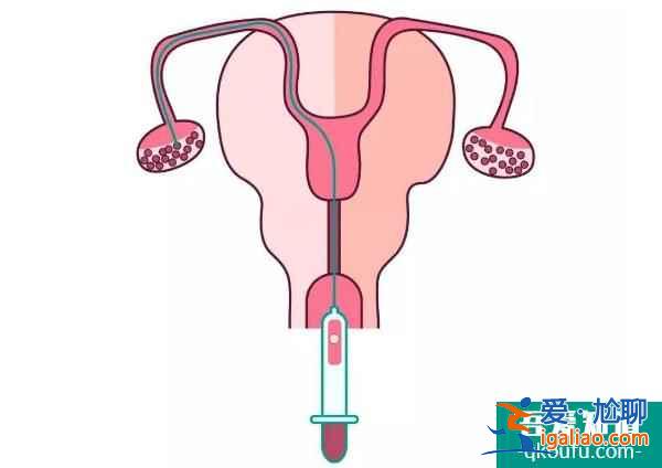 试管婴儿促排与乳腺癌之间是否有关系?？