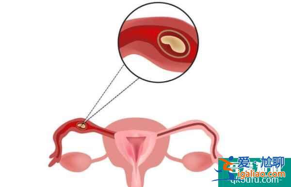 盘点:试管婴儿囊胚移植有哪些优势?? 盘点:试管婴儿囊胚移植有哪些优势??