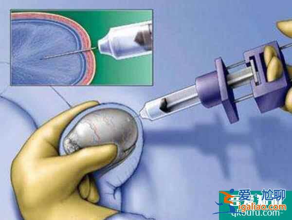 无精症去做试管婴儿,能生育健康宝宝吗?? 无精症去做试管婴儿,能生育健康宝宝吗??