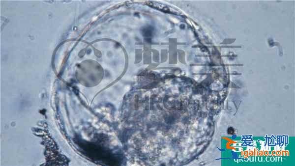 单身女性赴美做试管婴儿攻略:需做好准备? 单身女性赴美做试管婴儿攻略:需做好准备?