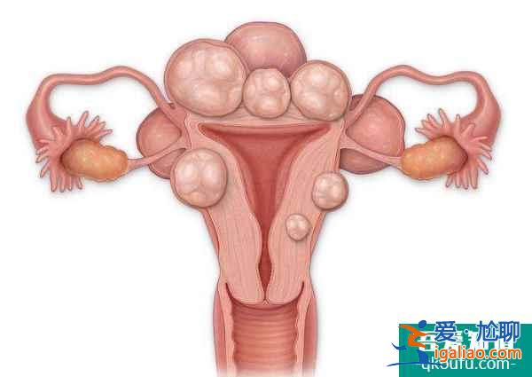 四类不孕女性的好孕锦囊—试管婴儿？