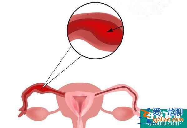 试管婴儿：输卵管囊肿会影响胚胎移植吗？？