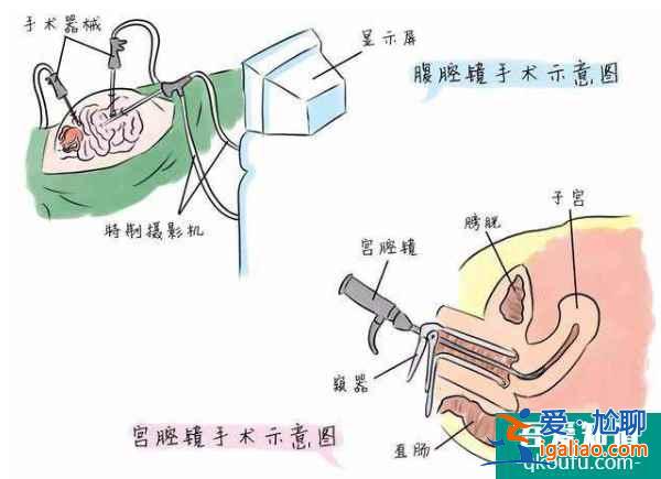 子宫息肉切除后，赴美做试管婴儿的三大好孕对策？