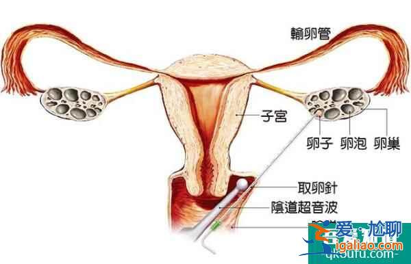 试管婴儿安全无痛周期，体现在四个方面？