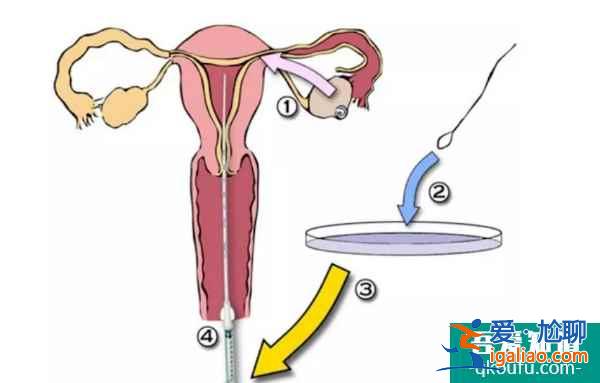女性双侧输卵管堵塞还可以赴美做试管婴儿吗？？