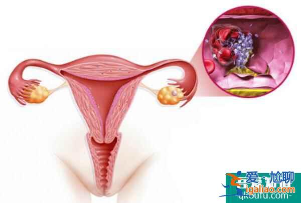 致卵巢储备功能低的3个因素？